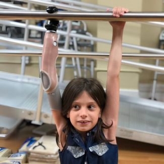 pediatric prosthetic arm